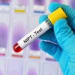 What Is a NIPT Test and Why Is It Important During Pregnancy?