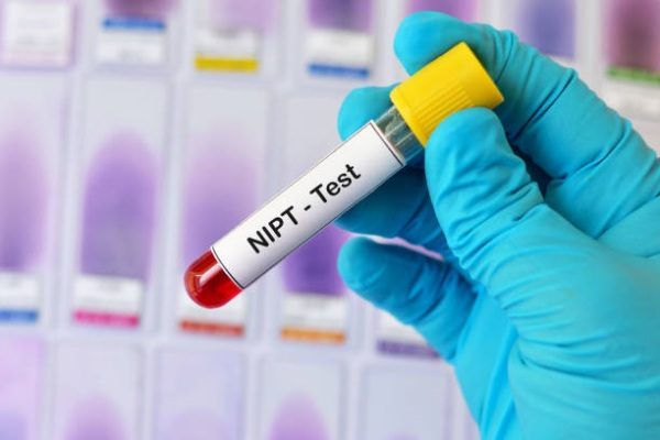 What Is a NIPT Test and Why Is It Important During Pregnancy?